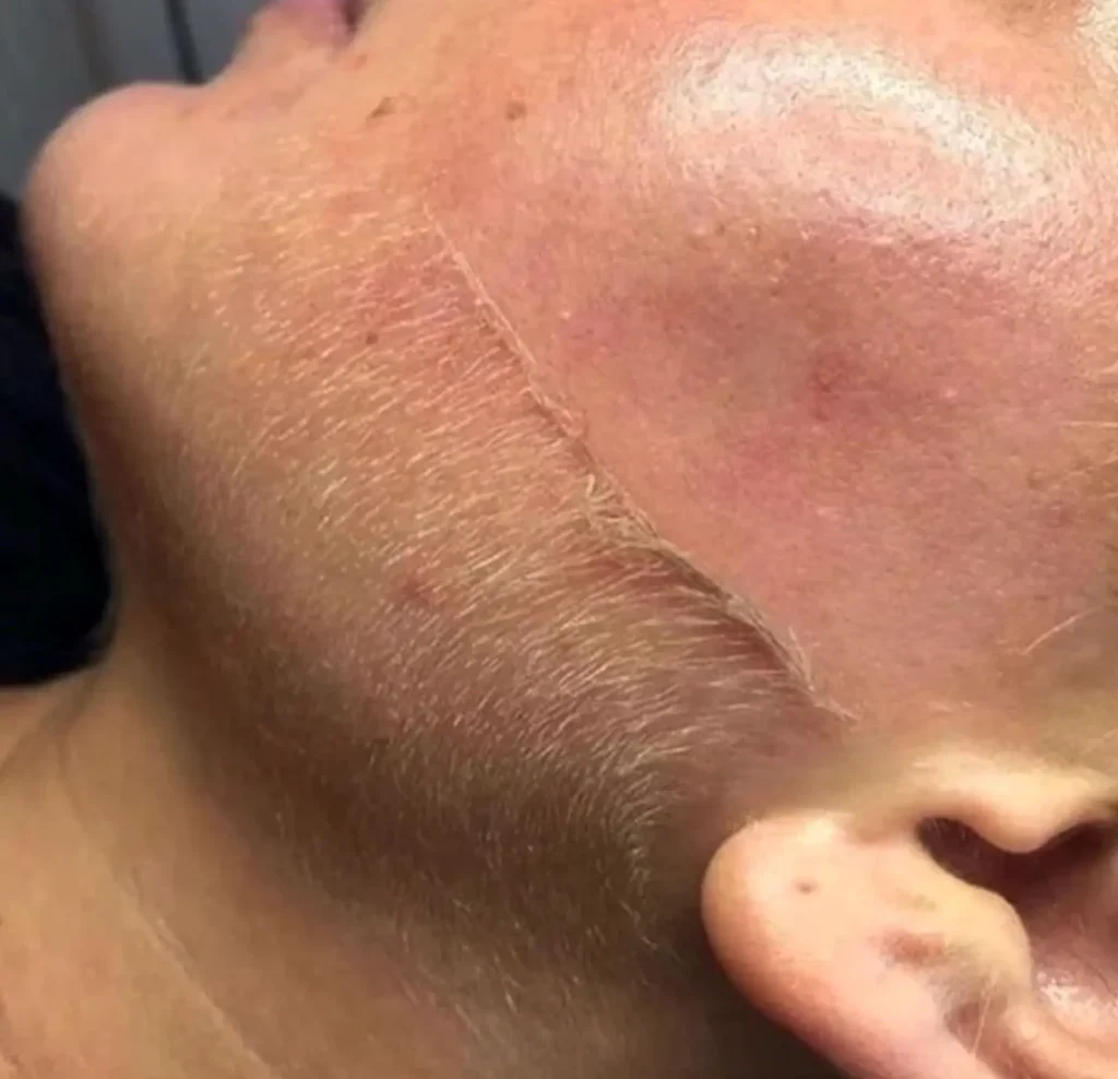 Good Eats Inc | What do dermatologists say about dermaplaning? It’s Good for Dullness and Dryness