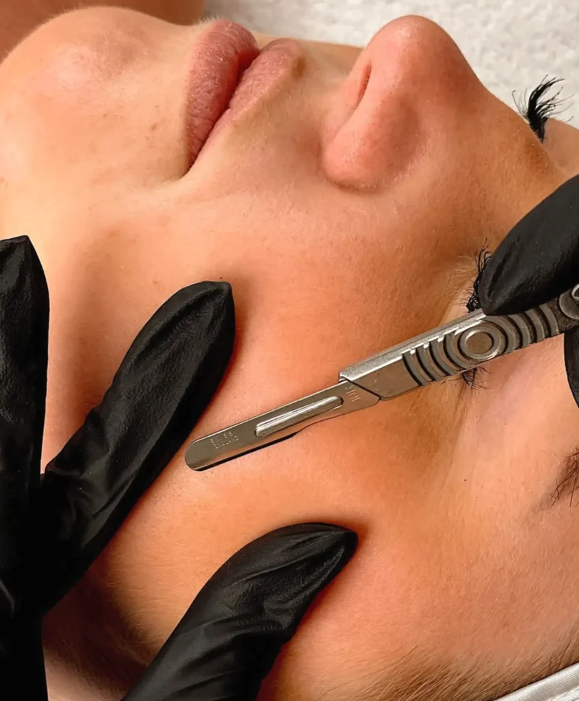 Good Eats Inc | What do dermatologists say about dermaplaning? Prep & Aftercare