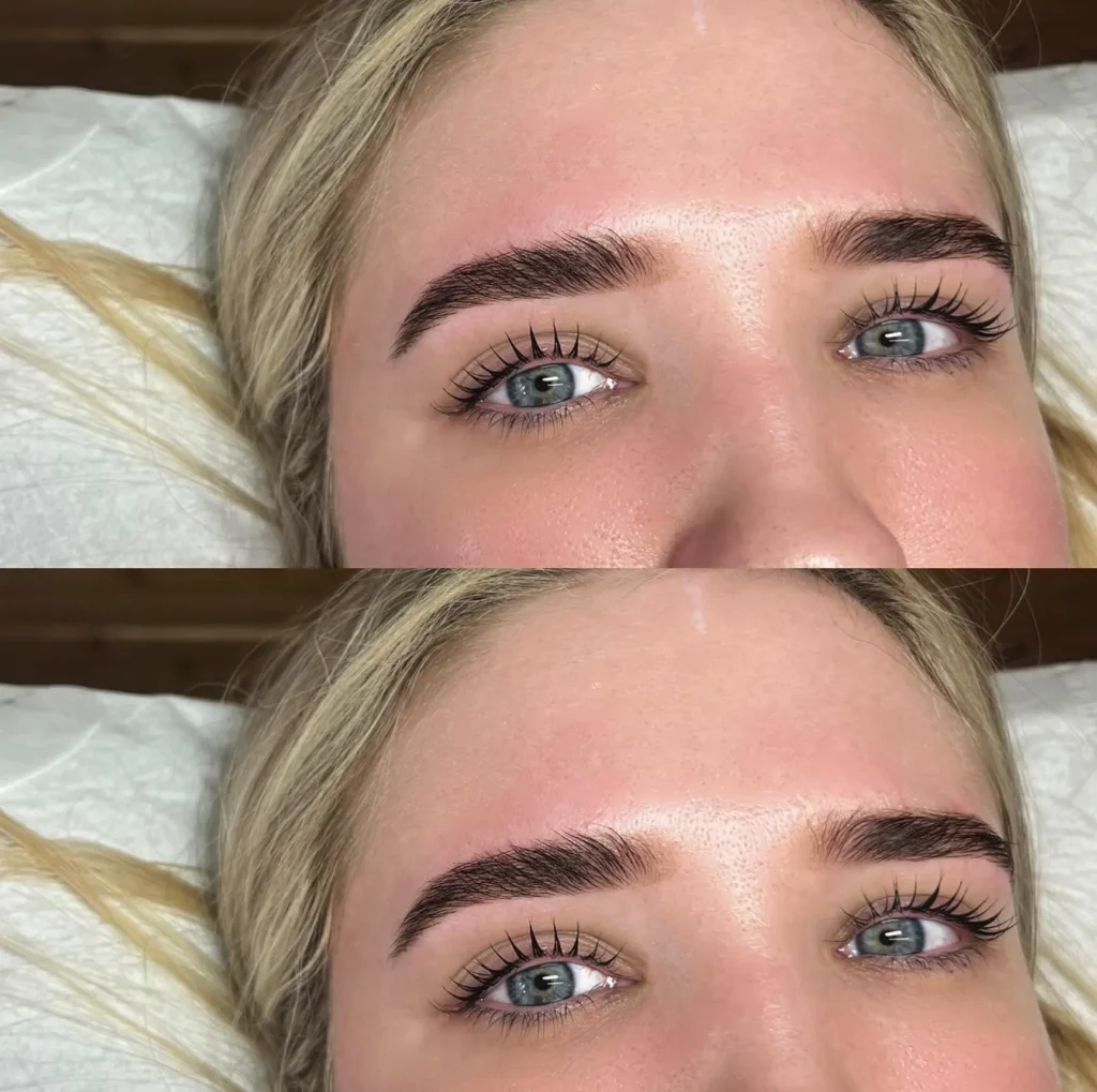 The Science Behind Skin and Pigment