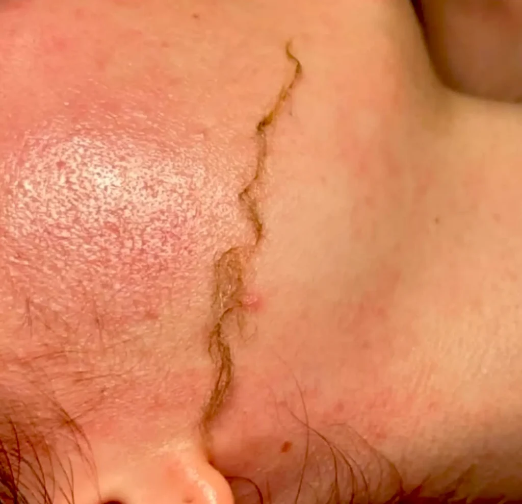 Good Eats Inc | What do dermatologists say about dermaplaning? What Dermatologists Say