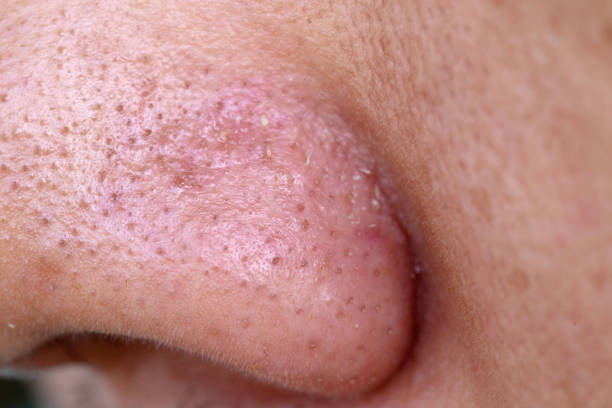 Close-up of a nose with visible pores and skin texture