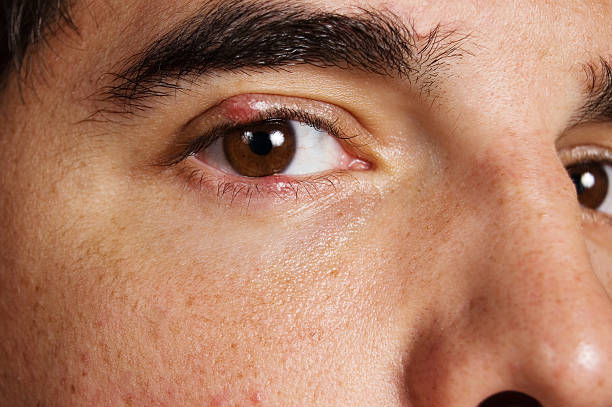 Close-up of a man's eye showing detailed texture of the skin and brown iris